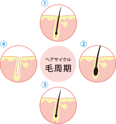 머리주기