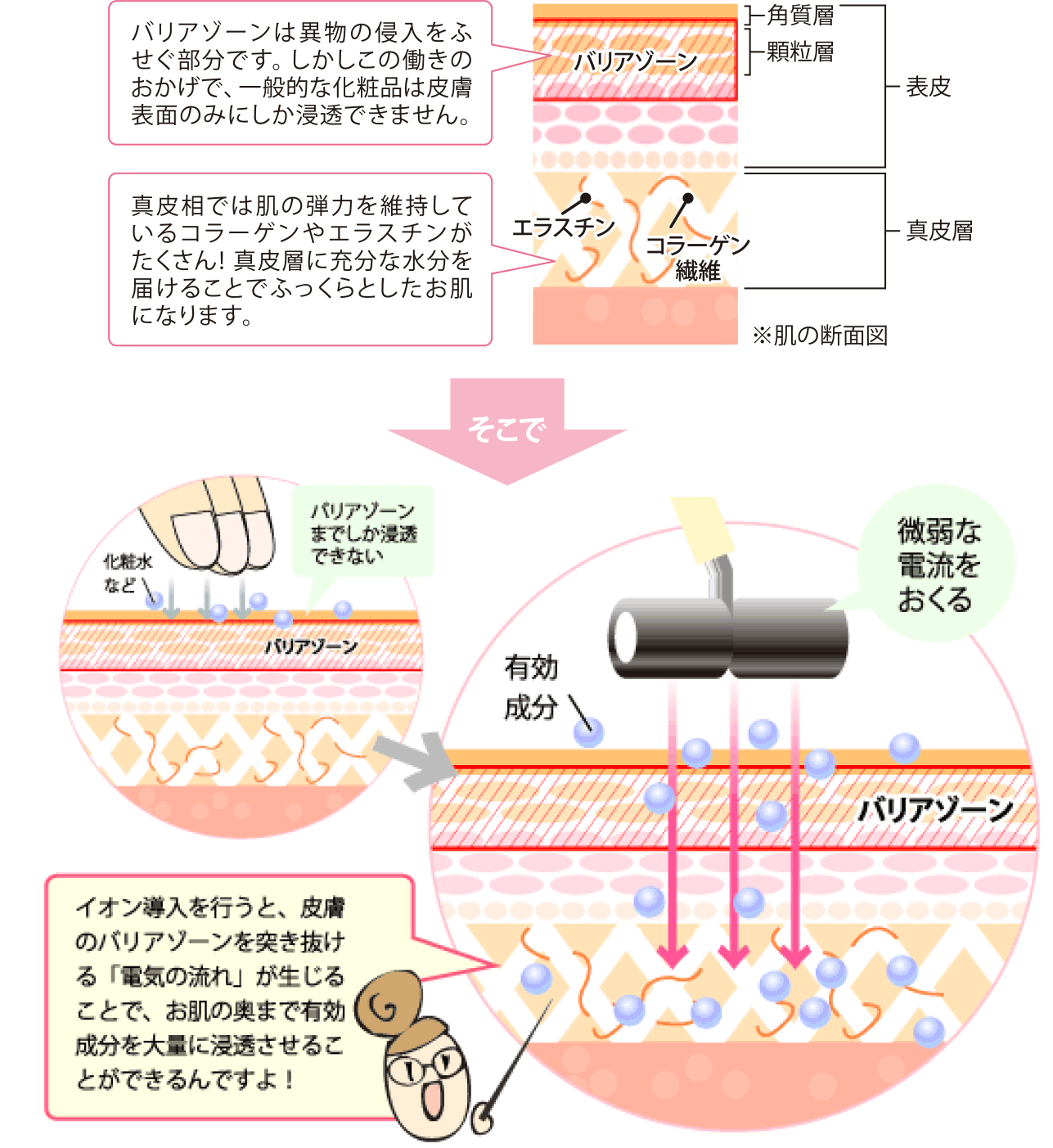 イオン導入・超音波導入｜美容皮膚科エルムクリニック