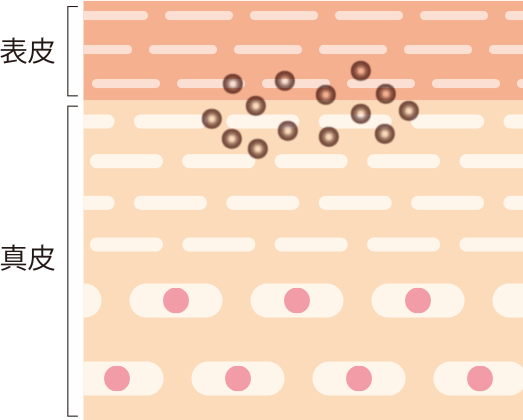 shallow part of the skin